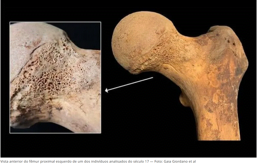 cannabis-achada-ossos-seculo-17 Vestígios de Cannabis são encontrados em ossos do século 17